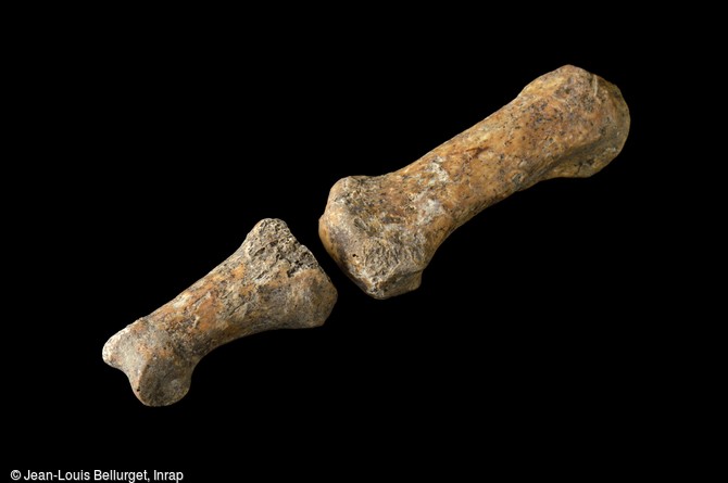 Phalanges d'un doigt de pestif&eacute;r&eacute;, victime de la peste noire de 1348, exhum&eacute; &agrave; Bondy (Seine-Saint-Denis). 