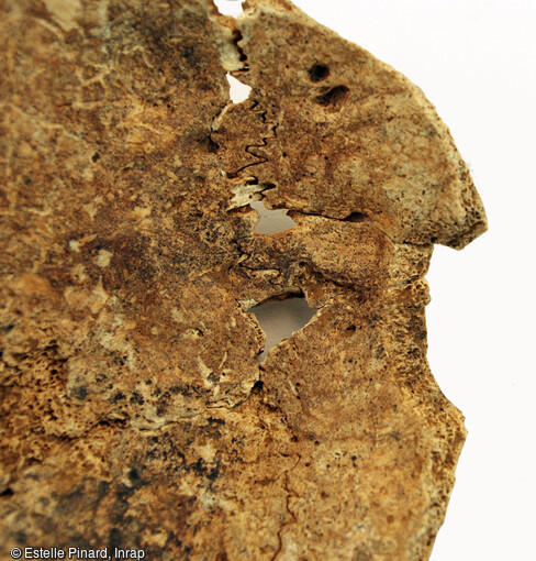 Traces de coup et de d&eacute;coupe sur les pari&eacute;taux d'un adulte en vue de l'ouverture de la bo&icirc;te cr&acirc;nienne. Ossement provenant d'une fosse du sanctuaire gaulois de Saint-Just-en-Chauss&eacute;e (Oise). La date du d&eacute;c&egrave;s de l'individu se situe entre le d&eacute;but du 2e et la fin du 1er si&egrave;cle av. notre &egrave;re.