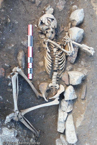 Individu inhumé à l'époque carolingienne, tête au sud avec un collier de perles et un bassin en fer mis au jour à La Flotte sur l'île de Ré (Charente-Maritime). Ses membres sont repliés et surélevés, position inhabituelle, il reste à confirmer si cette position est volontaire ou liée à l'effondrement de l'architecture de la tombe. La position de la tête au sud sort de la norme, dans les cimetières chrétiens, la tête est à l'ouest.