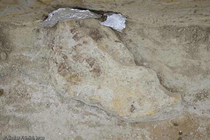 Mandibule de rhinocéros consolidée avec des bandes plâtrées, découverte au cours  de la fouille de la rue du Soleil levant à Abbeville (Somme). 